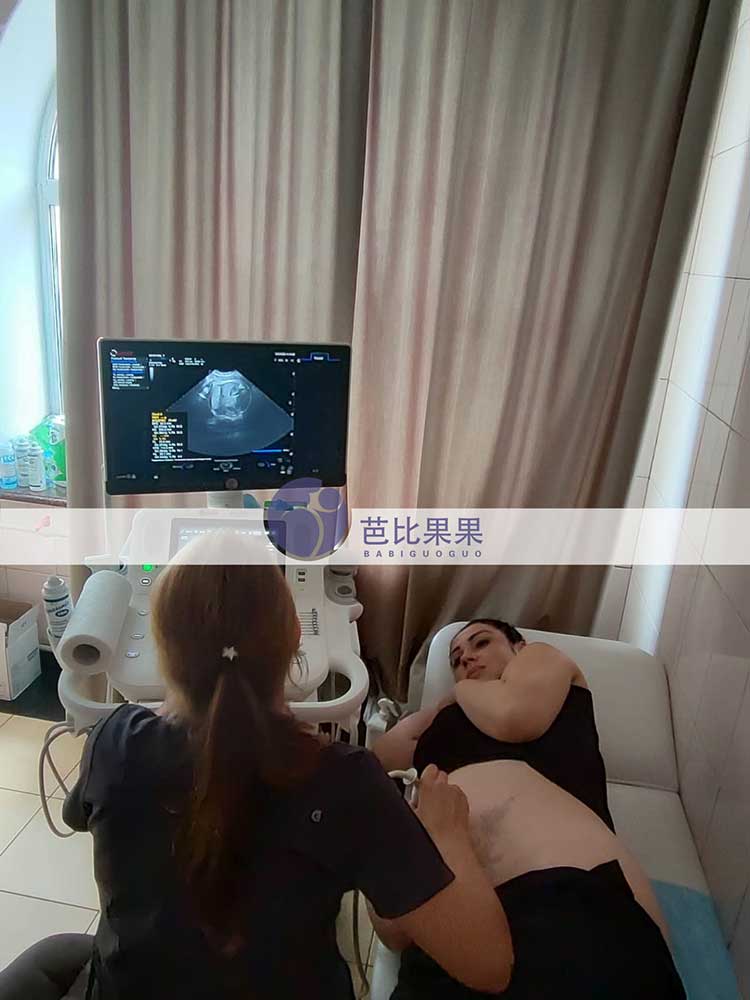 乌克兰试管妈妈B超