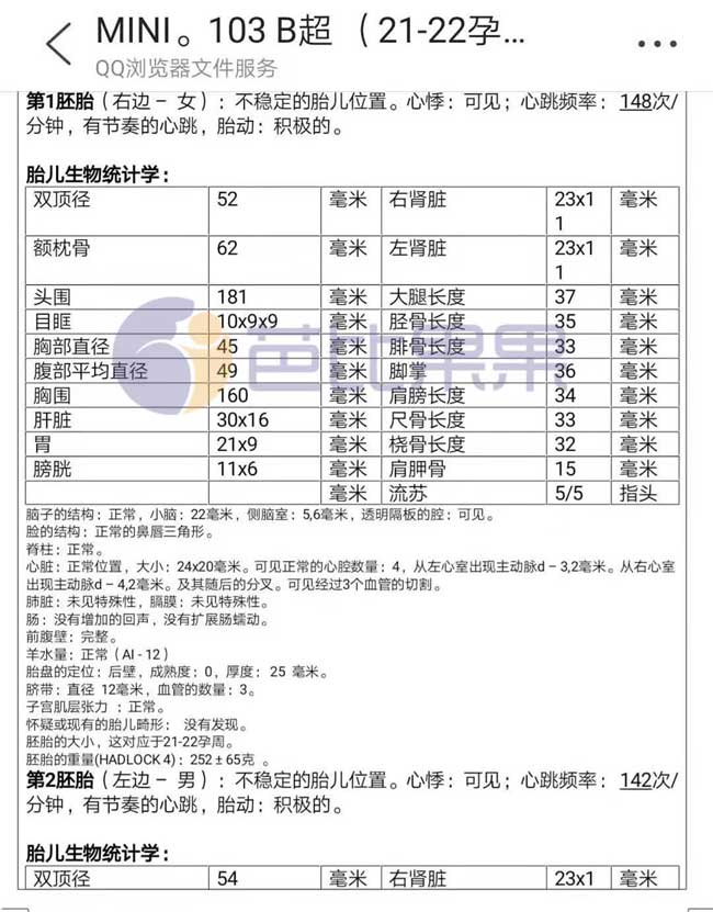 马丽塔孕妈孕21周的检查