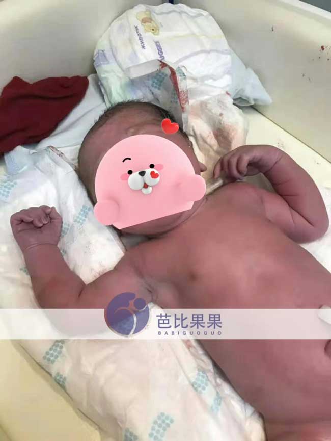 马丽塔代妈试管代怀包成功出生男宝宝