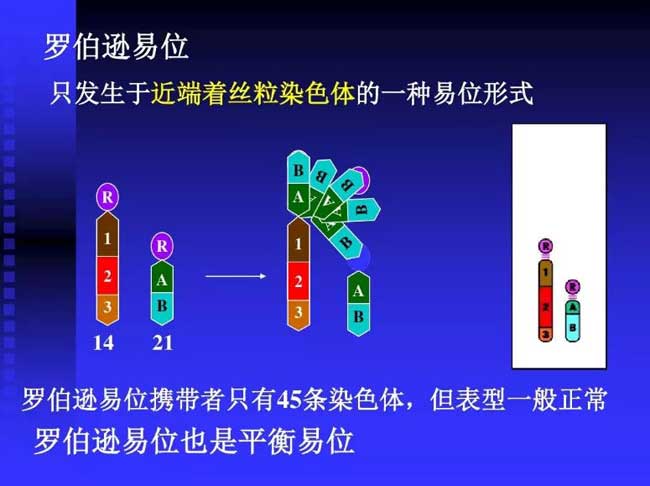 染色体罗氏易位